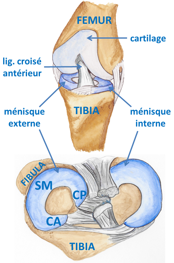 Fissure Ménisque Réunion – 974 – arthroscopie – méniscectomie ...